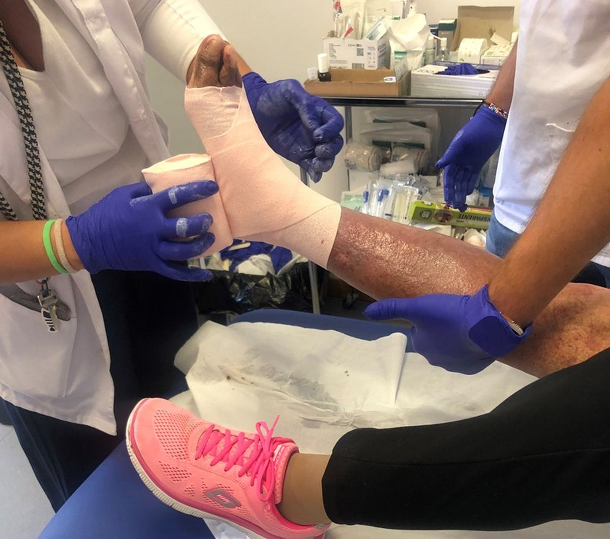 Salamanca estrena una unidad especializada para el tratamiento de heridas complejas