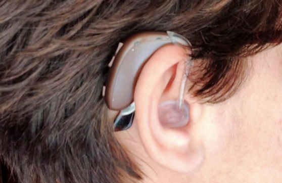Recogen firmas para que las ayudas a audífonos no terminen a los 26 años