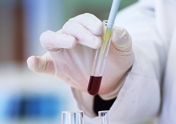 Nueva investigación para mejorar las terapias contra el cáncer