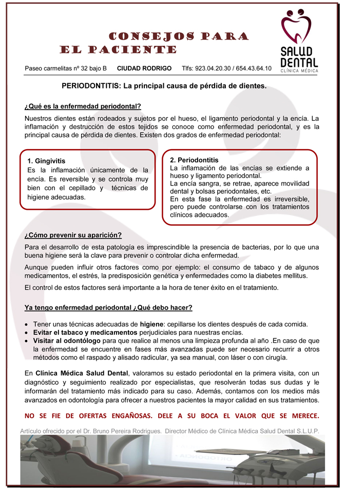 Periodontitis, la principal causa de pérdida de dientes