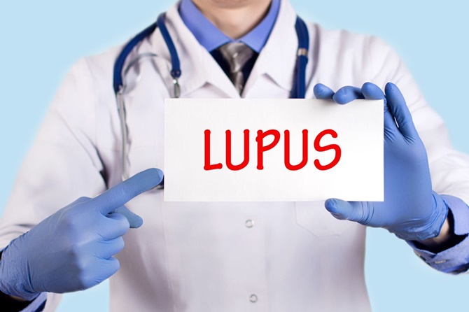 El 10 de mayo se celebra el Día Mundial del Lupus
