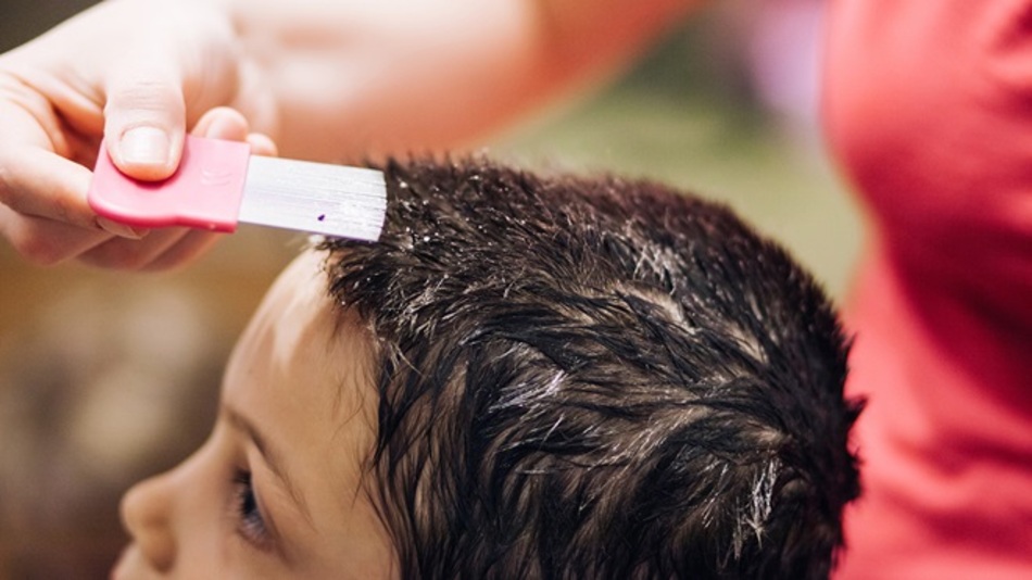 Utilizar los pediculicidas siguiendo las instrucciones de uso. Foto: OCU