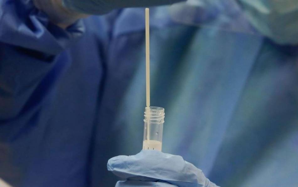 Prueba de detección de la Covid-19